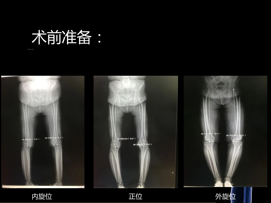 HTO_第9页
