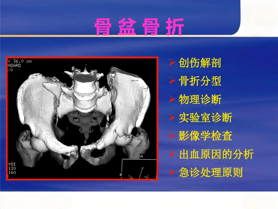 骨盆骨折急诊处理的一般原则_第2页