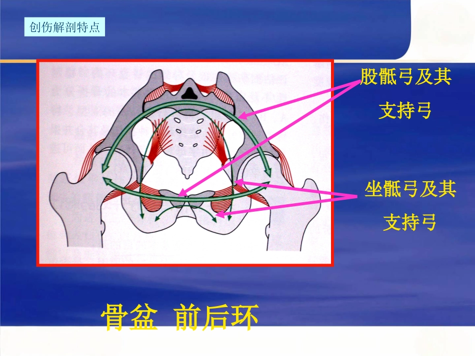 骨盆骨折急诊处理的一般原则_第4页