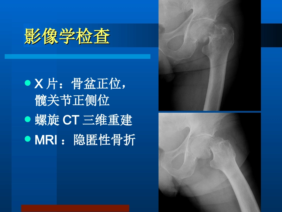 股骨颈骨折治疗选择_第10页