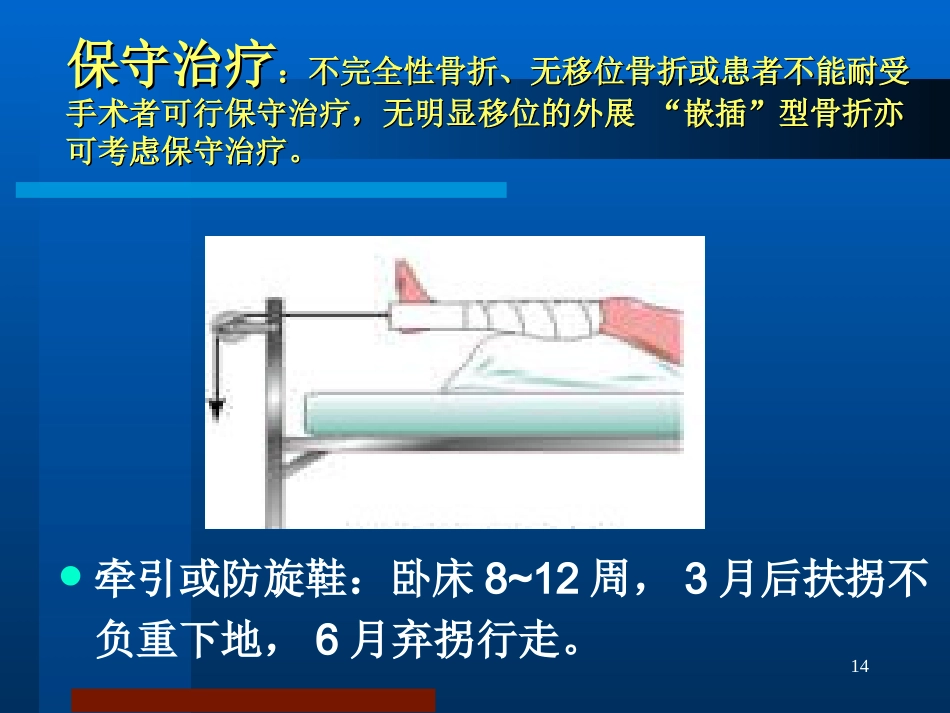 股骨颈骨折治疗选择_第14页