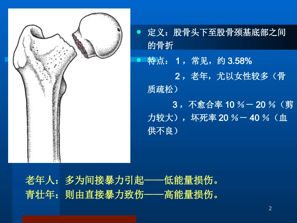 股骨颈骨折治疗选择_第2页