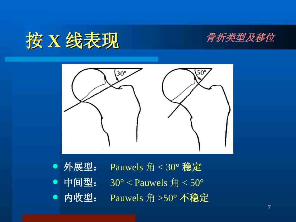股骨颈骨折治疗选择_第7页