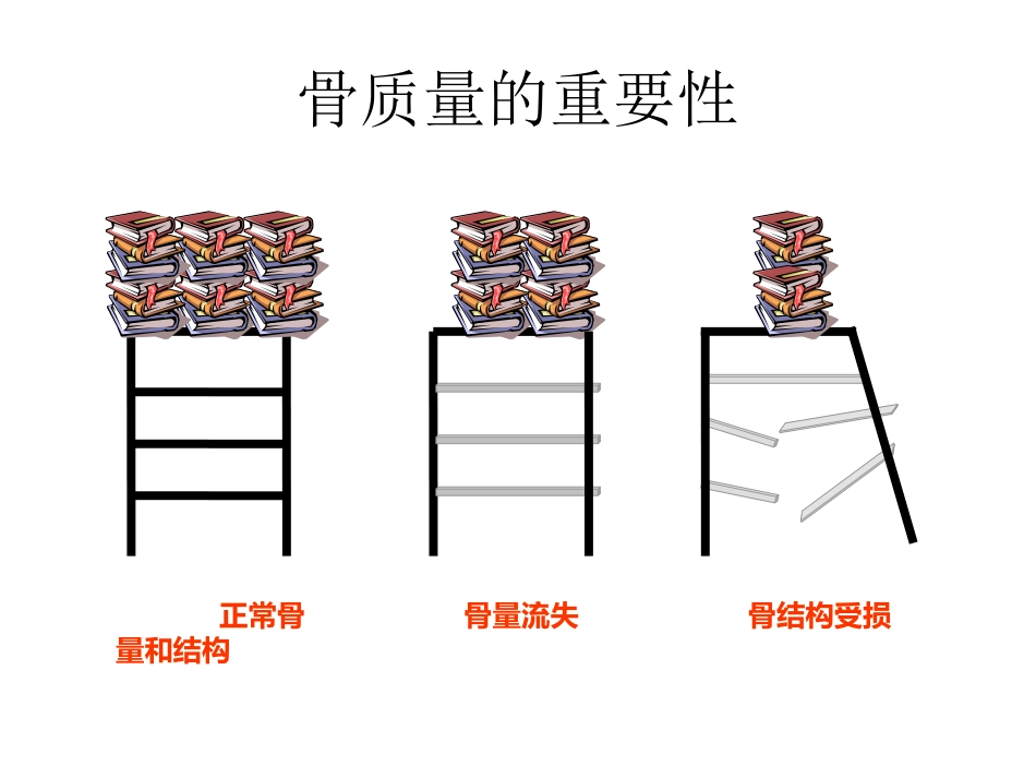 骨质疏松的诊断与治疗_第14页