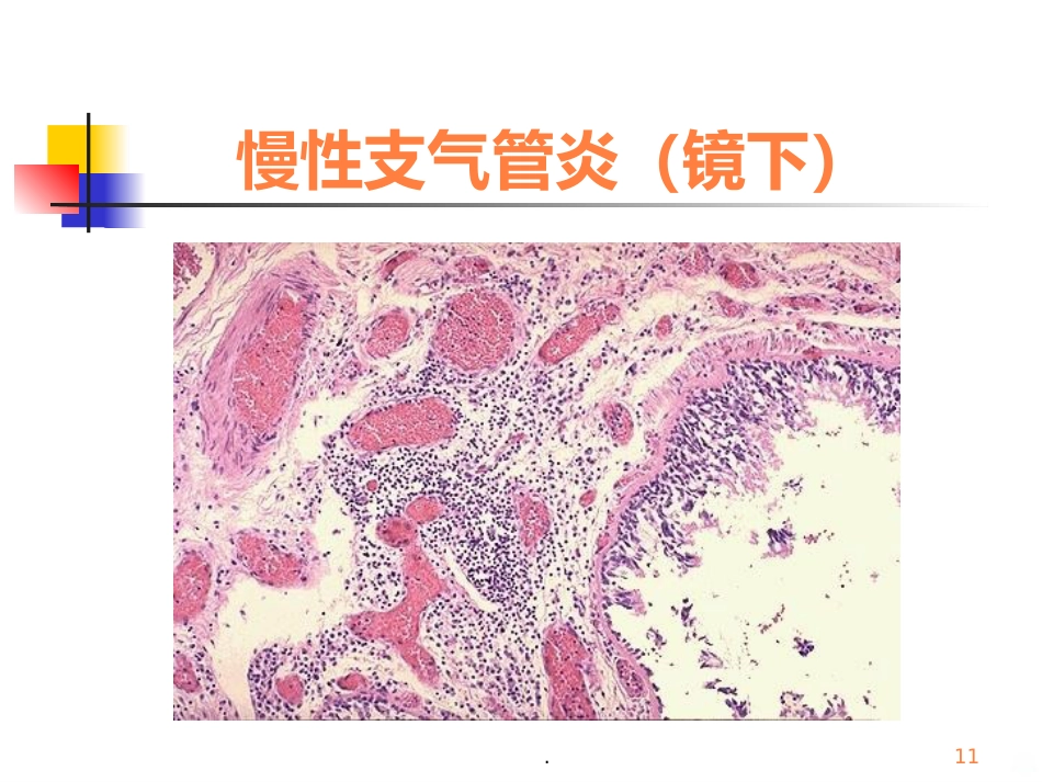 病理学呼吸疾病ppt课件_第11页