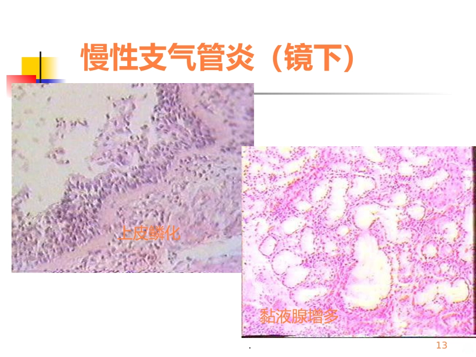 病理学呼吸疾病ppt课件_第13页