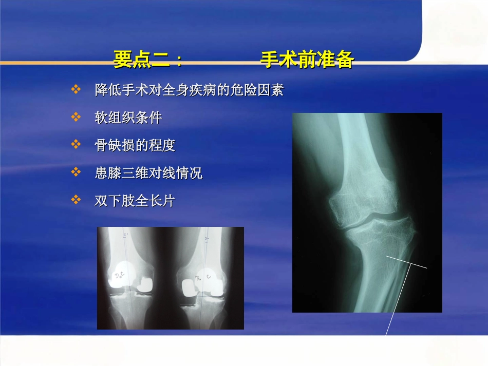 tka手术操作要点_第11页