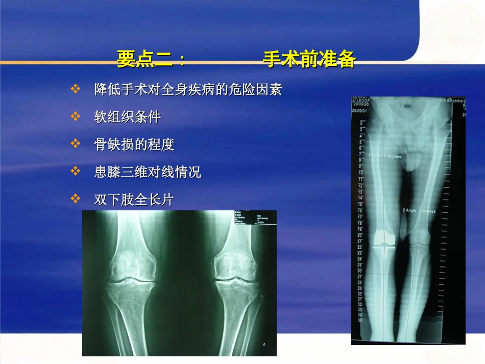 tka手术操作要点_第13页