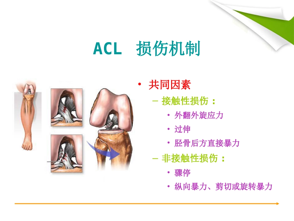 ACL重建篇_第14页