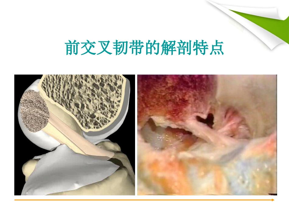 ACL重建篇_第5页