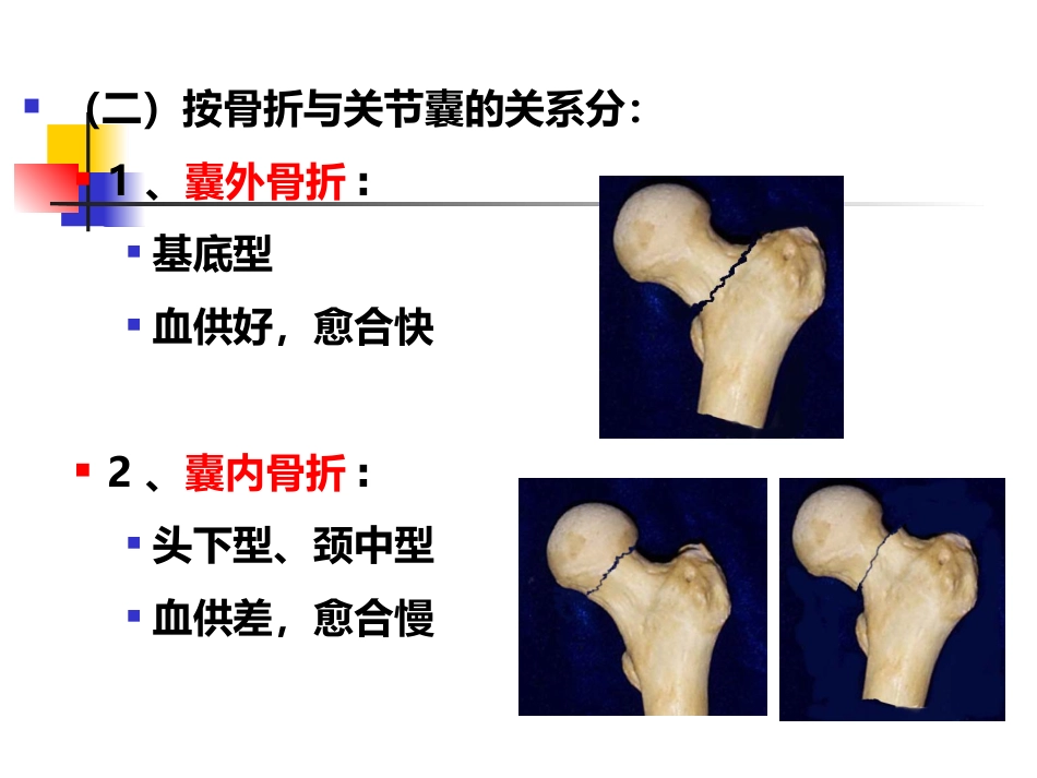 股骨颈骨折概述_第7页
