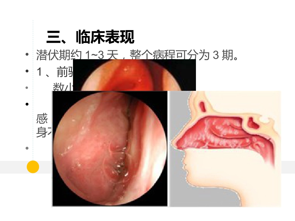 耳鼻喉科-鼻炎和鼻窦炎_第7页