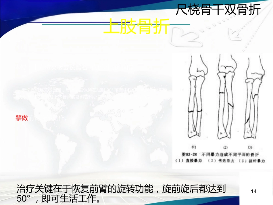 骨科体位护理_第14页
