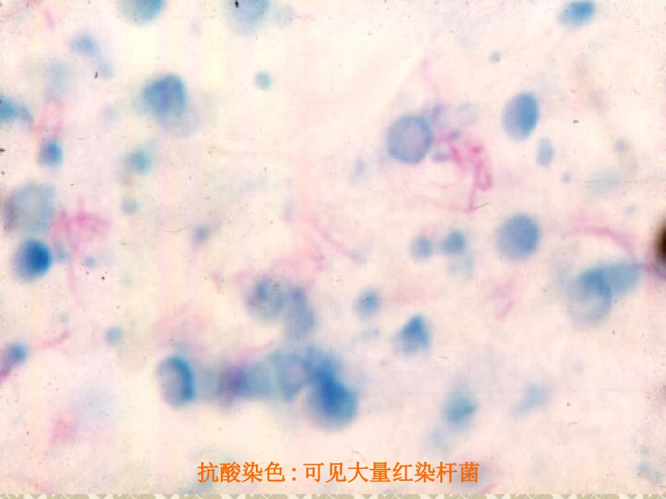 病理学传染病与寄生虫_第5页