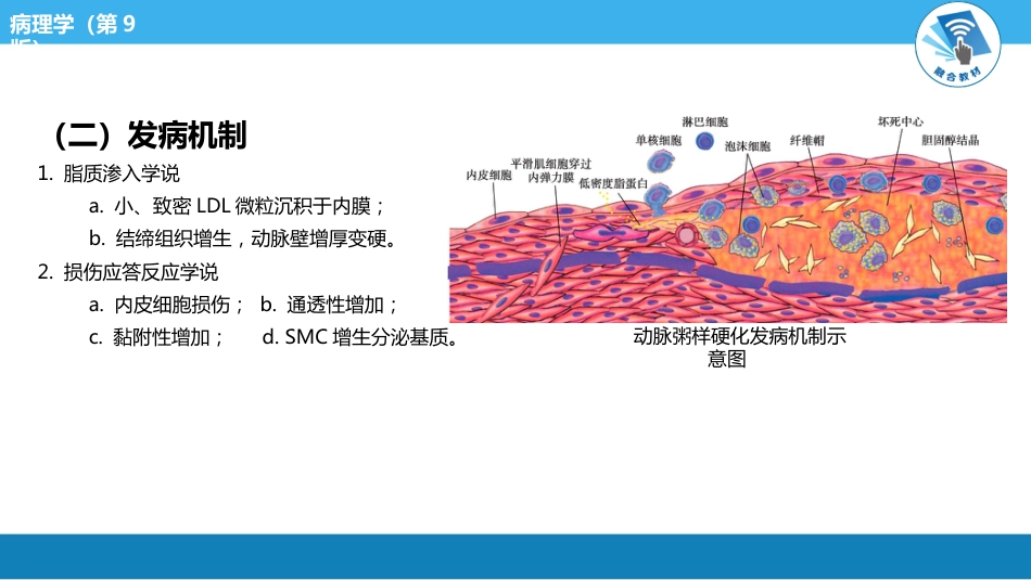 病理学-动脉粥样硬化PPT课件_第4页