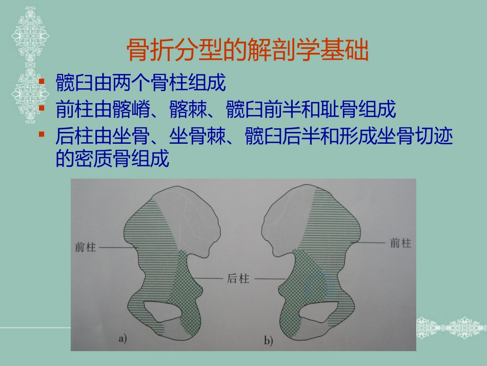 骨盆、髋臼骨折的分型_第12页