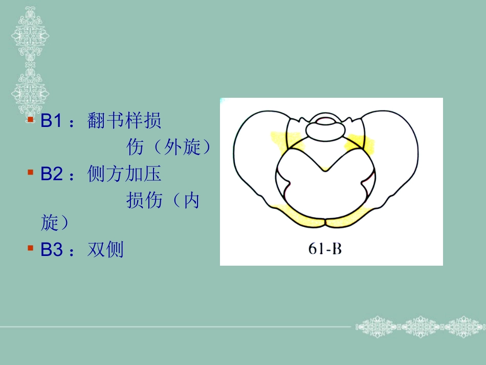 骨盆、髋臼骨折的分型_第5页