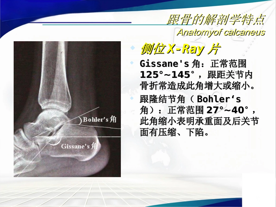 跟骨骨折的分型与治疗讲座_第3页