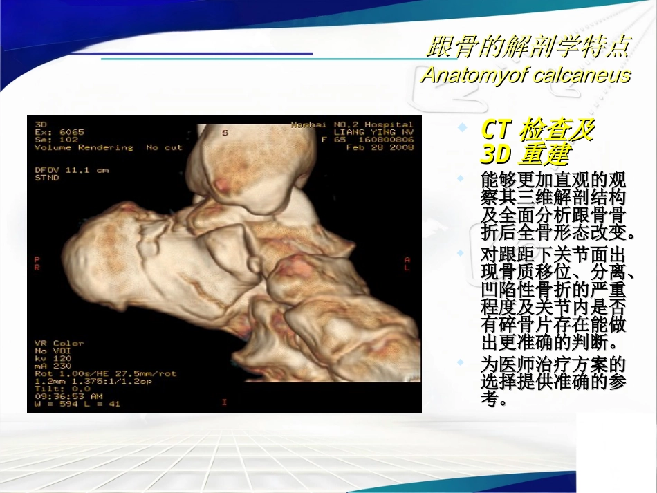跟骨骨折的分型与治疗讲座_第6页