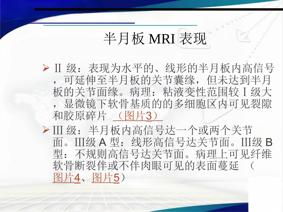 半月板损伤、交叉韧带及肩袖损伤的MR表现_第5页