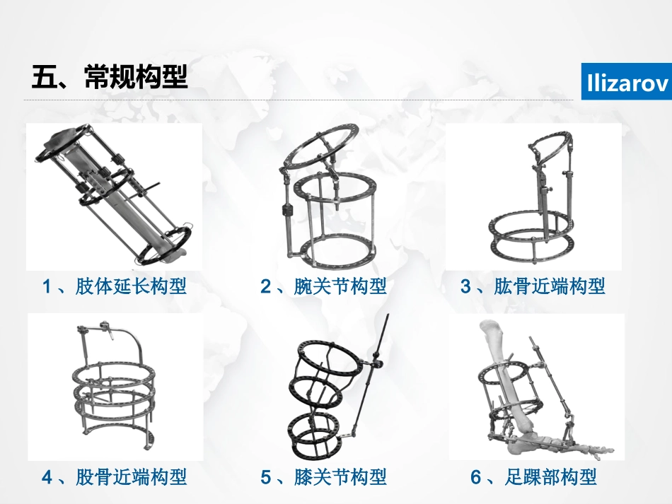 Ilizarov外固定架骨搬运术围手术期的护理_第11页