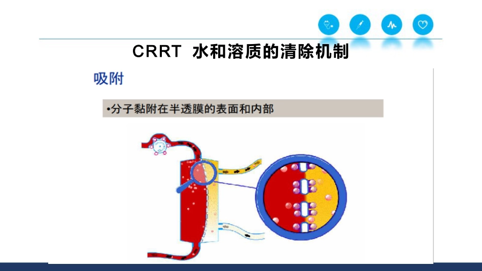 CRRT基本原理和治疗剂量_第14页