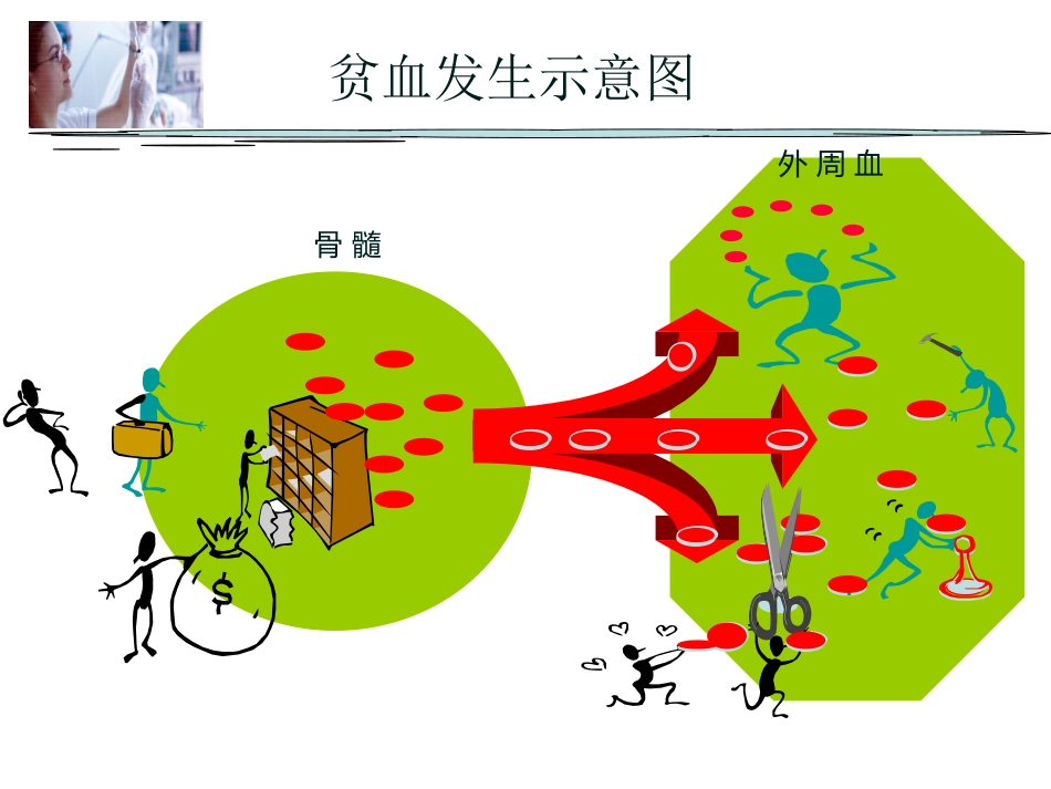 贫血概述_第2页