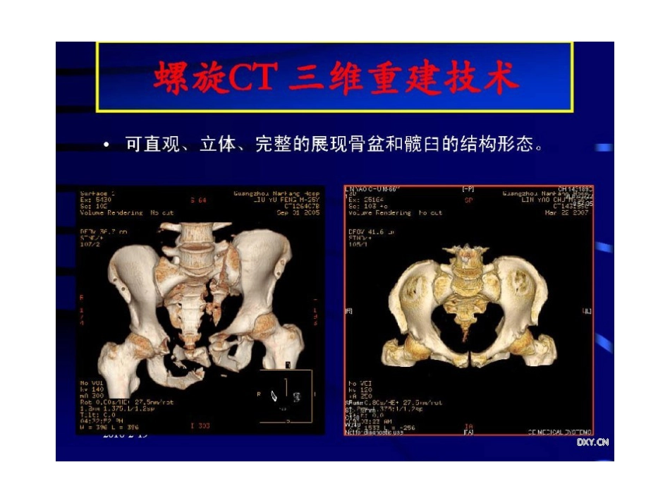 骨盆与髋臼骨折的诊断与分型_第11页