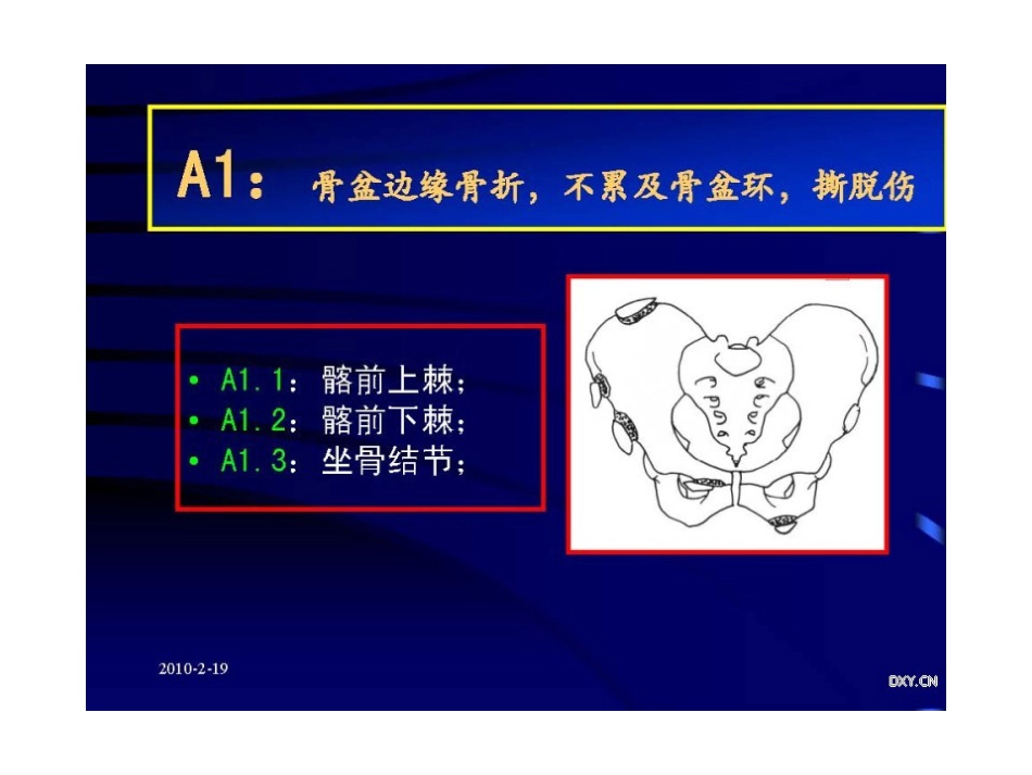 骨盆与髋臼骨折的诊断与分型_第15页