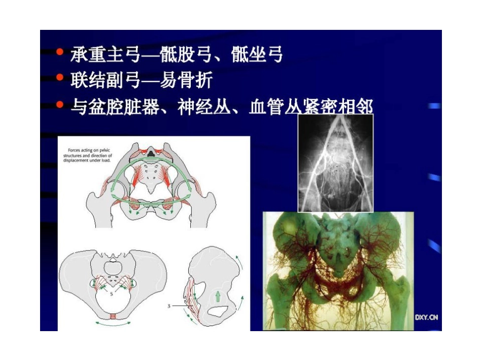 骨盆与髋臼骨折的诊断与分型_第4页
