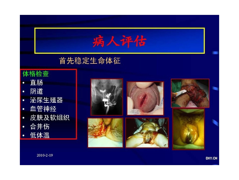 骨盆与髋臼骨折的诊断与分型_第5页