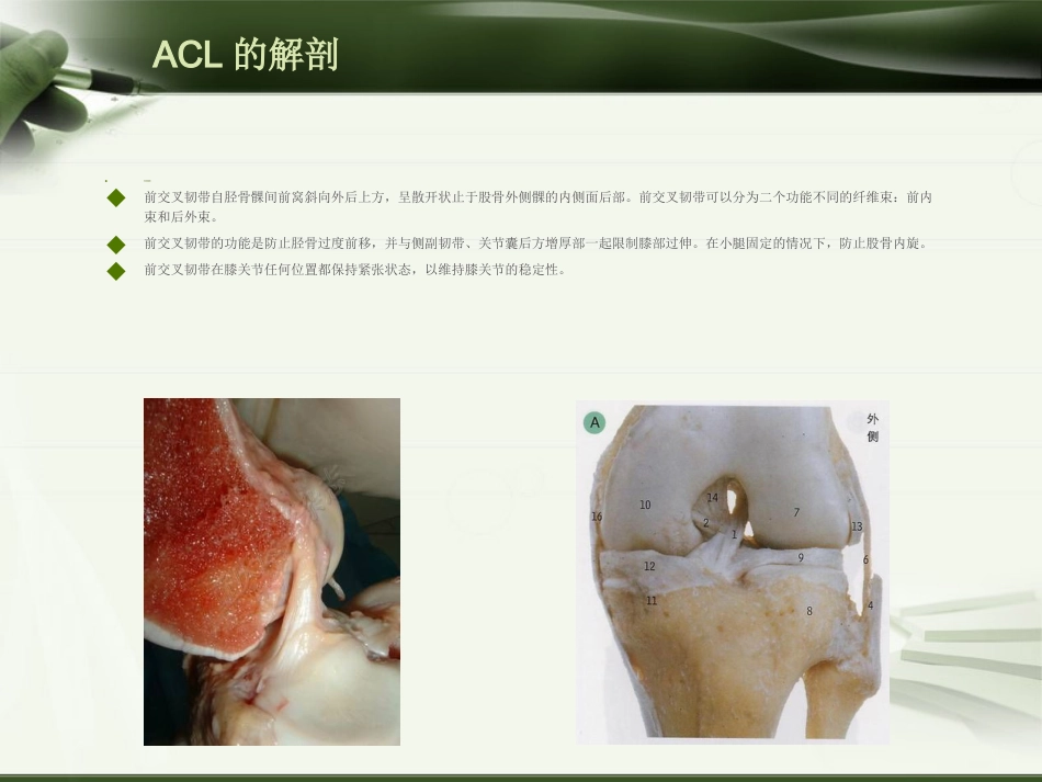 ACL损伤影像学诊断教程_第1页