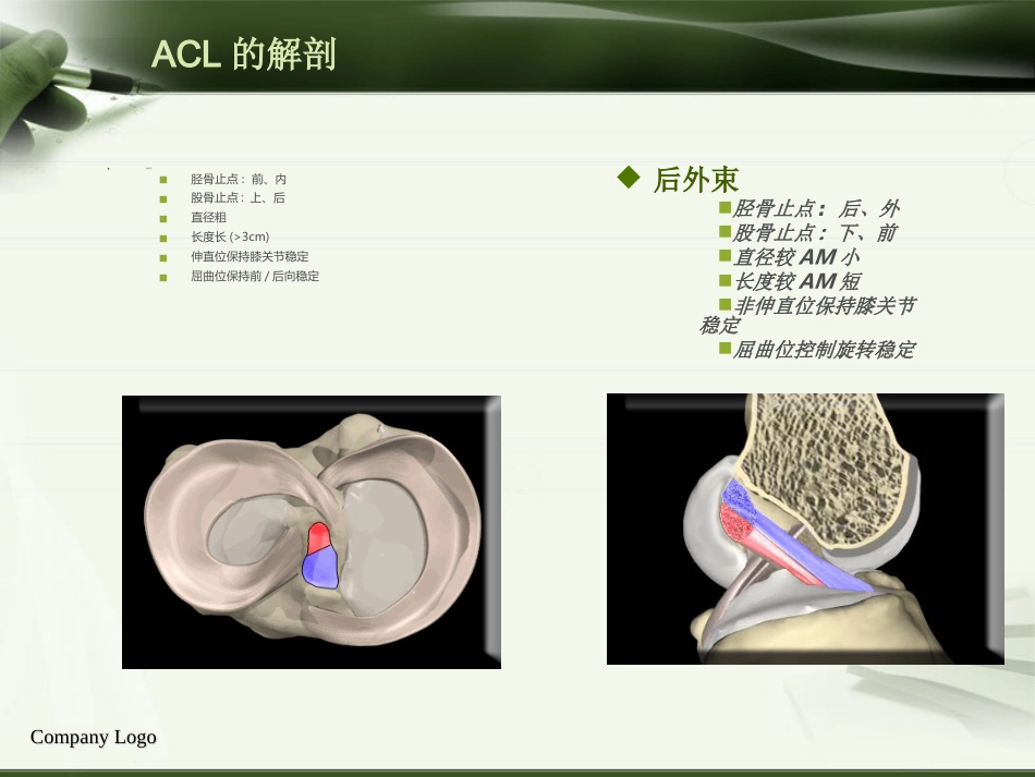 ACL损伤影像学诊断教程_第3页