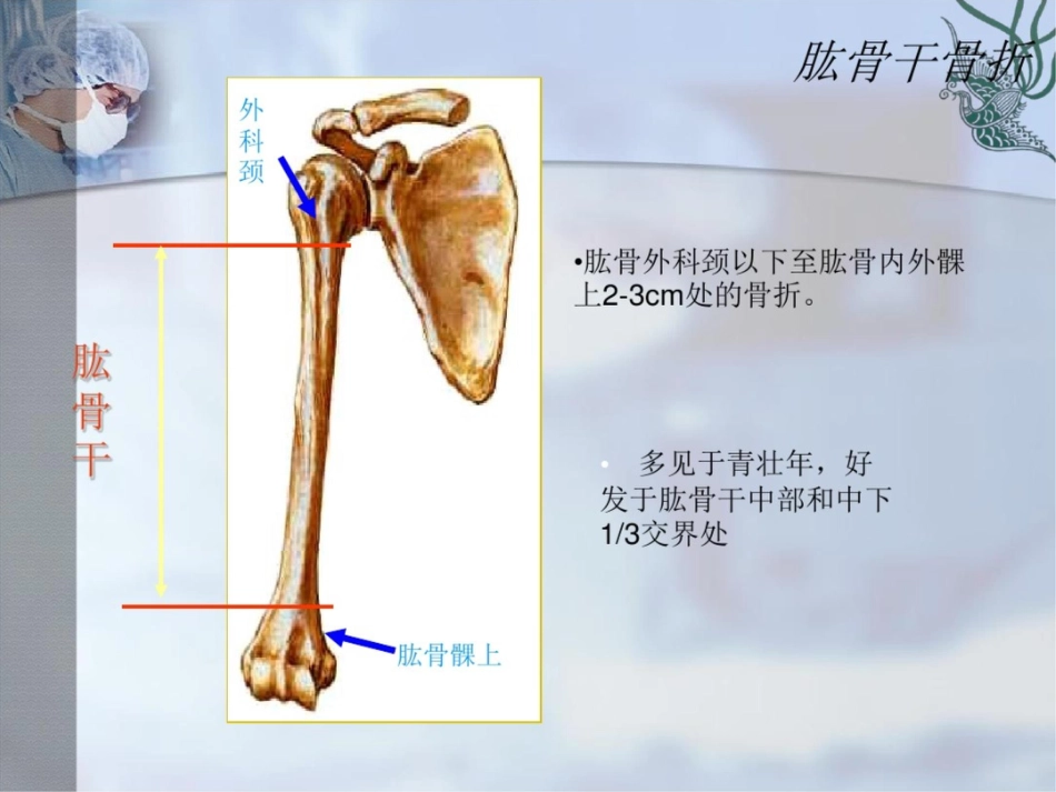 肱骨干骨折PPT课件_第2页