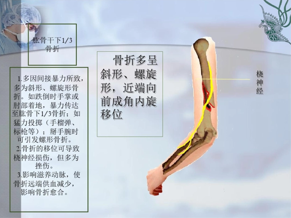 肱骨干骨折PPT课件_第7页