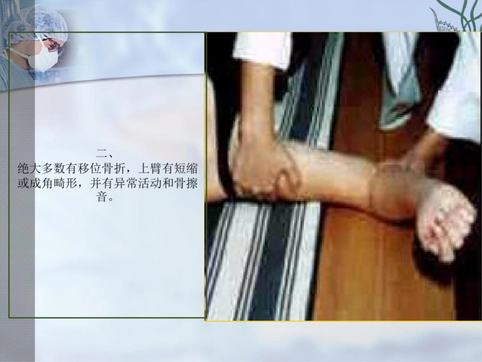 肱骨干骨折PPT课件_第9页