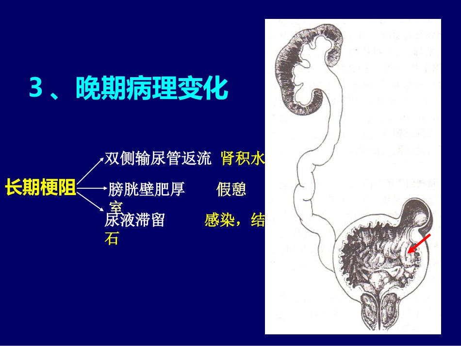 良性前列腺增生症_第10页
