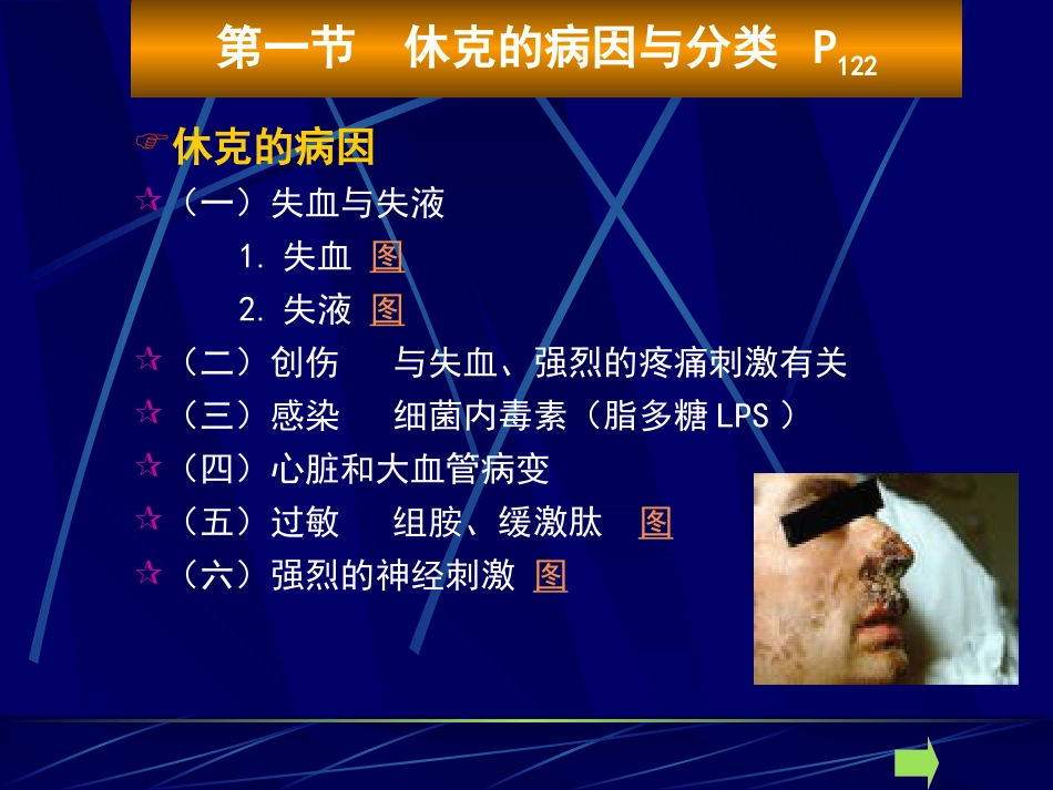 病理学课件休克_第4页