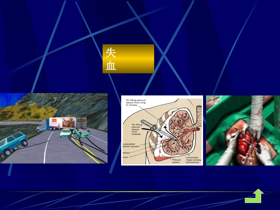 病理学课件休克_第7页