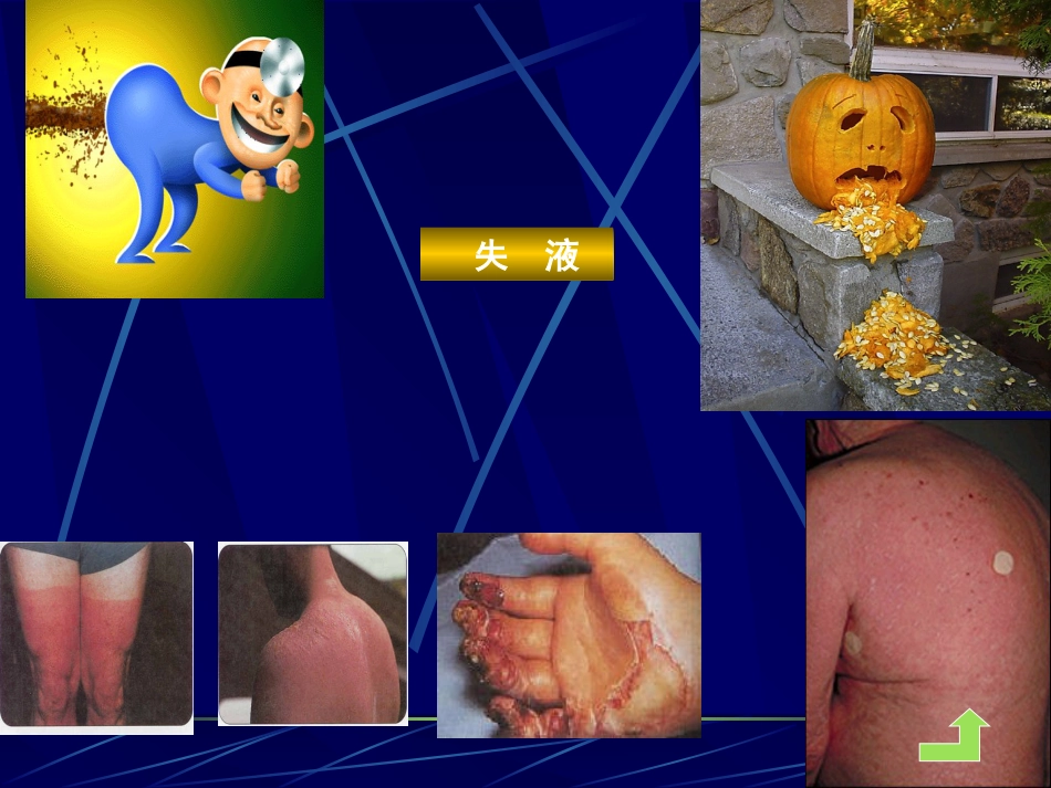 病理学课件休克_第8页