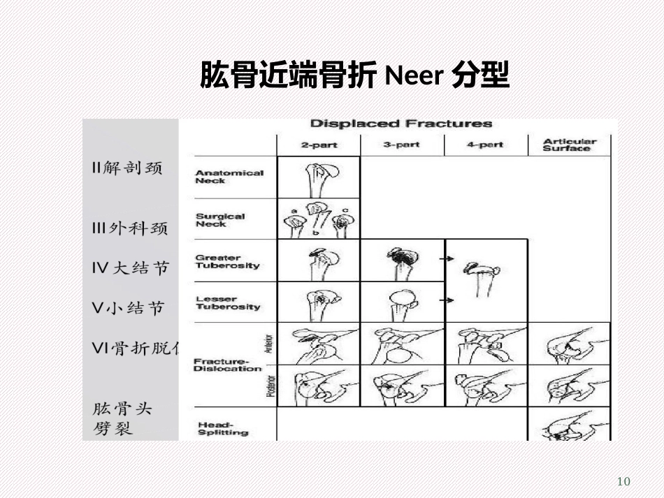 肱骨近端骨折分型及治疗_第10页
