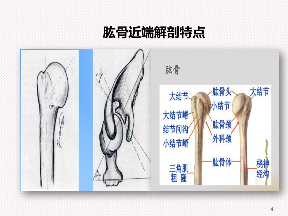 肱骨近端骨折分型及治疗_第4页