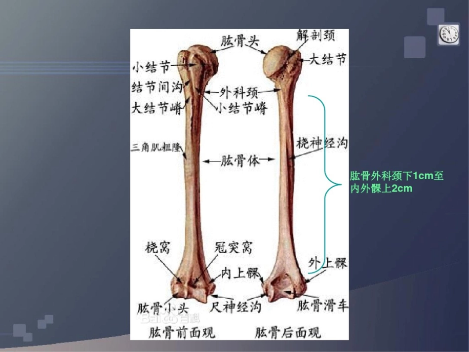 肱骨干骨折讲解_第2页
