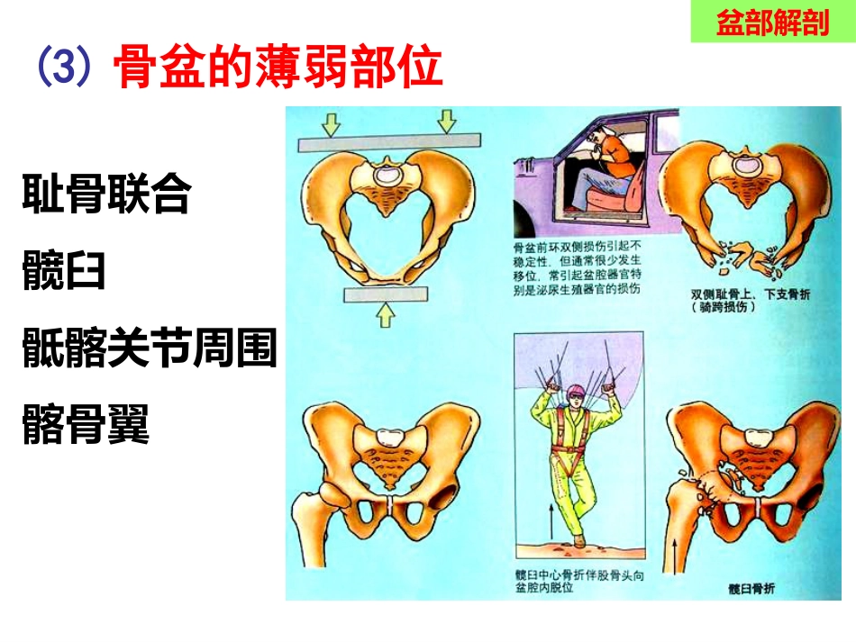 骨盆手术入路应用解剖-最新_第10页