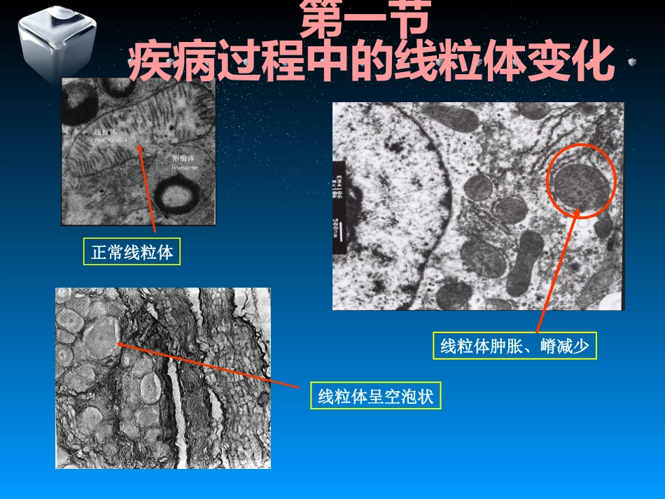 包括mtDNA异常导致的线粒体病_第6页