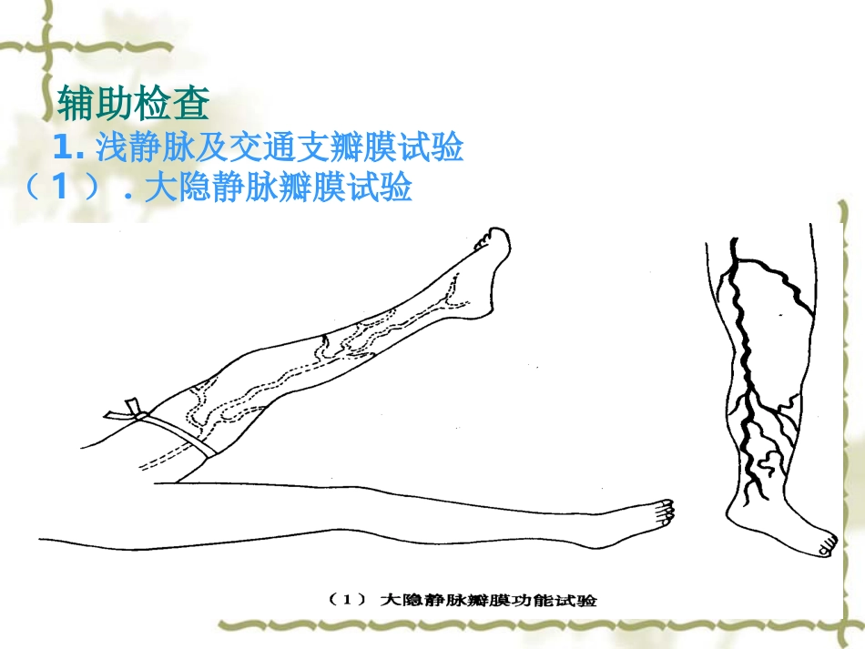 下肢静脉曲张病人的护理_第13页