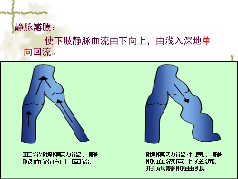 下肢静脉曲张病人的护理_第5页