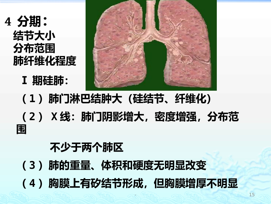 病理学 矽肺 肺心病 ARDS 肺癌ppt课件_第15页