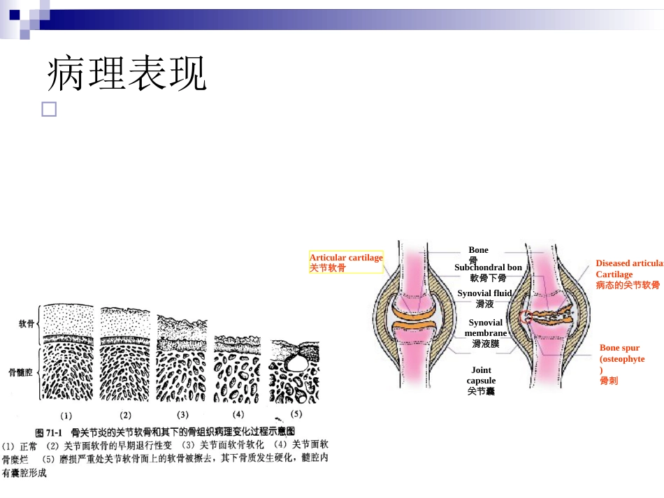 骨关节炎治疗_第13页