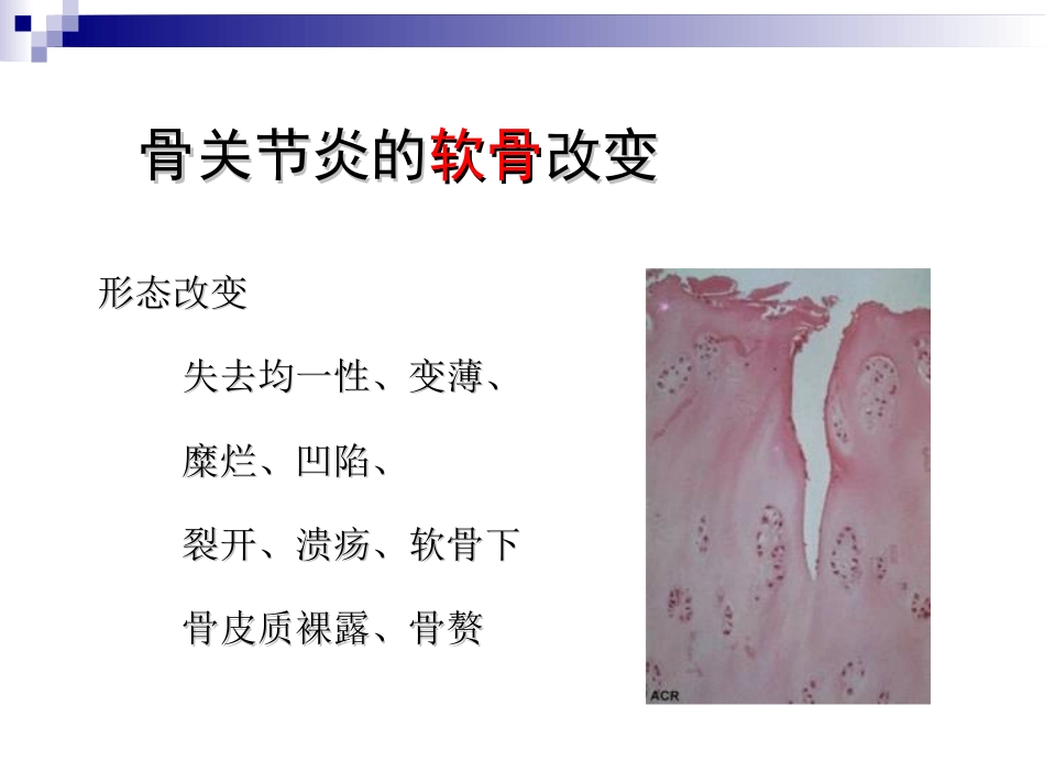骨关节炎治疗_第15页